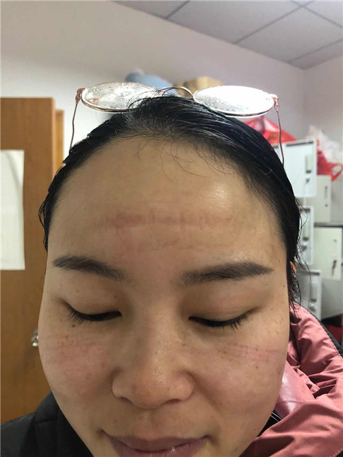 抗疫工作日志系列之一——疫情就是命令