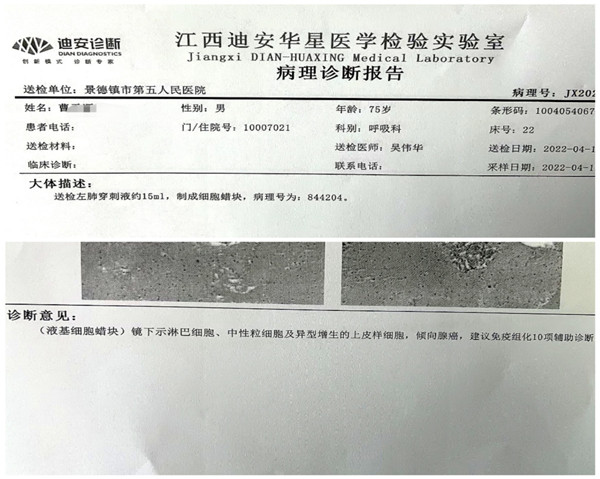 市五院成功为古稀老人开展CT引导下经皮肺穿刺活检术