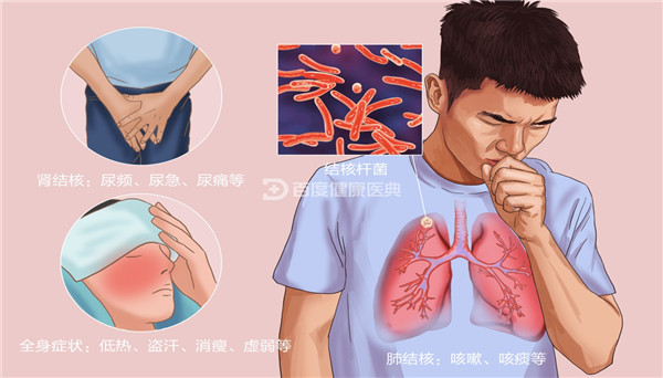 感染性疾病知多少？