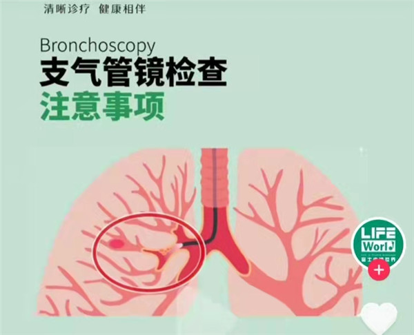 气管镜检查注意事项
