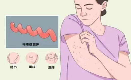 梅毒螺旋体的检验方法