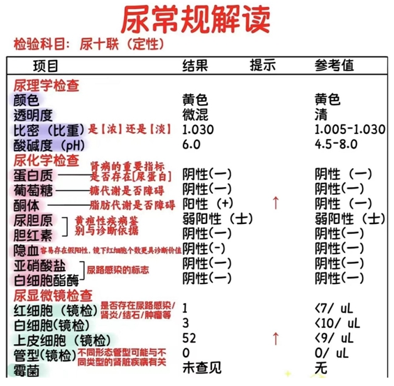 尿常规检查的临床意义