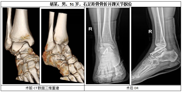 胸外科