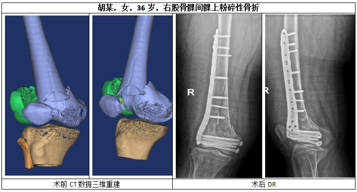胸外科