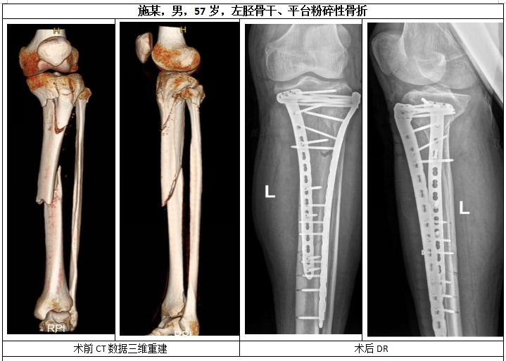 胸外科
